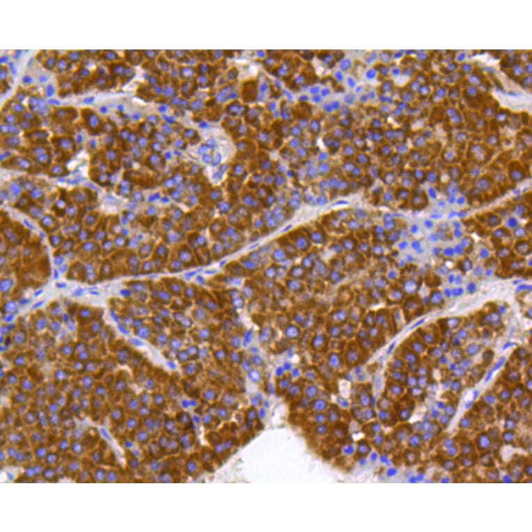 Immunohistochemistry - Anti-PHB Antibody (A11077) - Antibodies.com