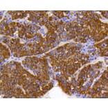 Immunohistochemistry - Anti-PHB Antibody (A11077) - Antibodies.com