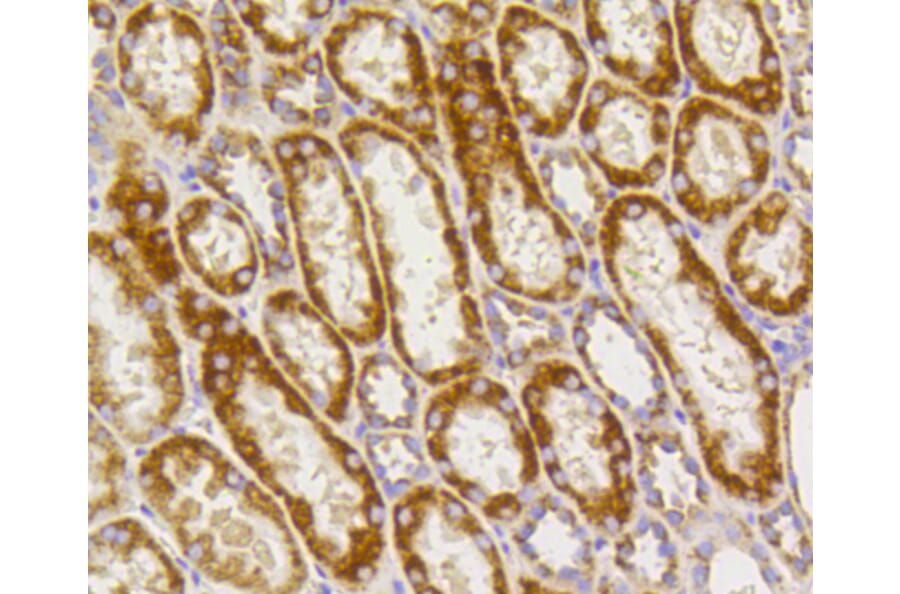 Immunohistochemistry - Anti-PHB Antibody (A11077) - Antibodies.com