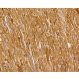 Immunohistochemistry - Anti-PHB Antibody (A11077) - Antibodies.com