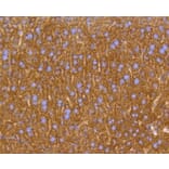 Immunohistochemistry - Anti-PHB Antibody (A11077) - Antibodies.com