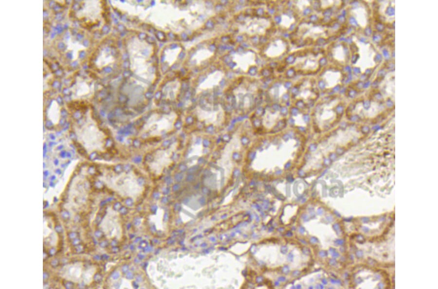 Immunohistochemistry - Anti-PHB Antibody (A11077) - Antibodies.com