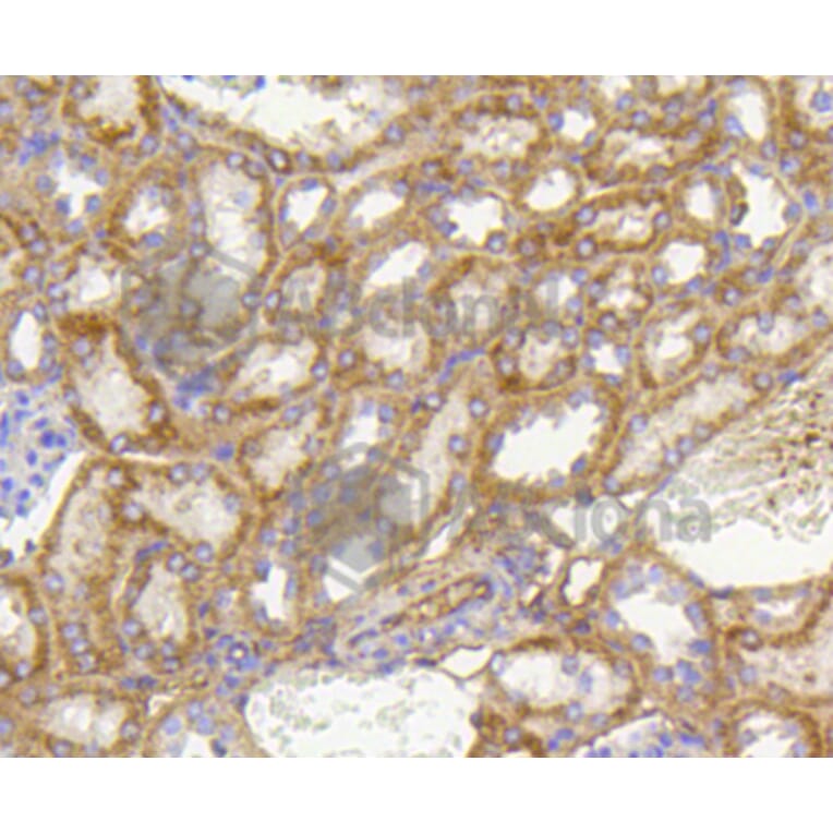 Immunohistochemistry - Anti-PHB Antibody (A11077) - Antibodies.com