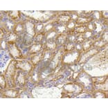 Immunohistochemistry - Anti-PHB Antibody (A11077) - Antibodies.com