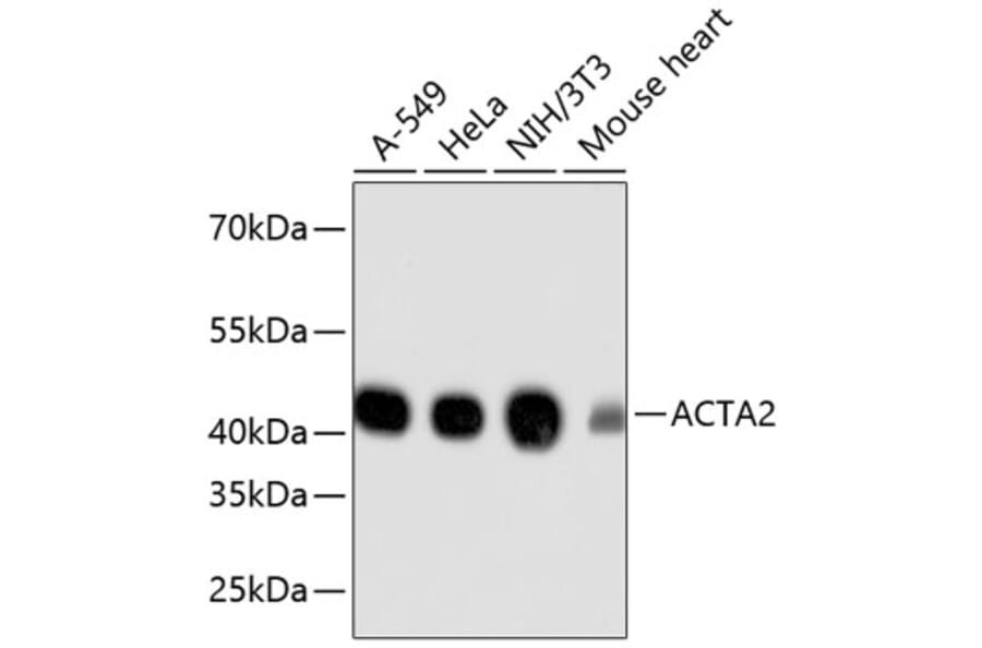 Western Blot - Anti-ACTA2 Antibody (A11111) - Antibodies.com