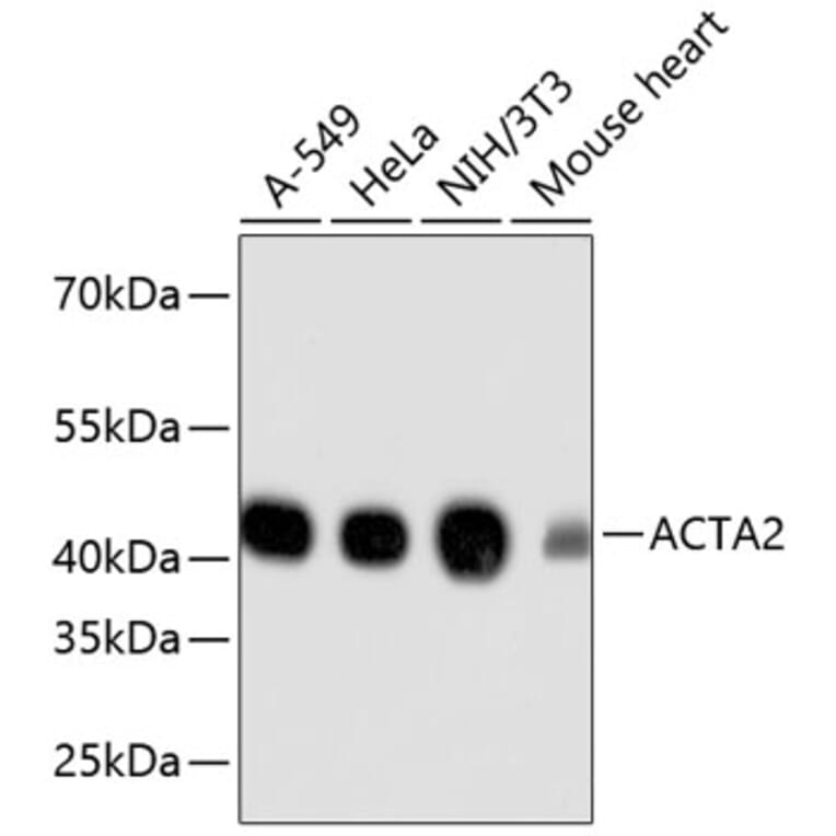 Western Blot - Anti-ACTA2 Antibody (A11111) - Antibodies.com