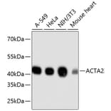 Western Blot - Anti-ACTA2 Antibody (A11111) - Antibodies.com