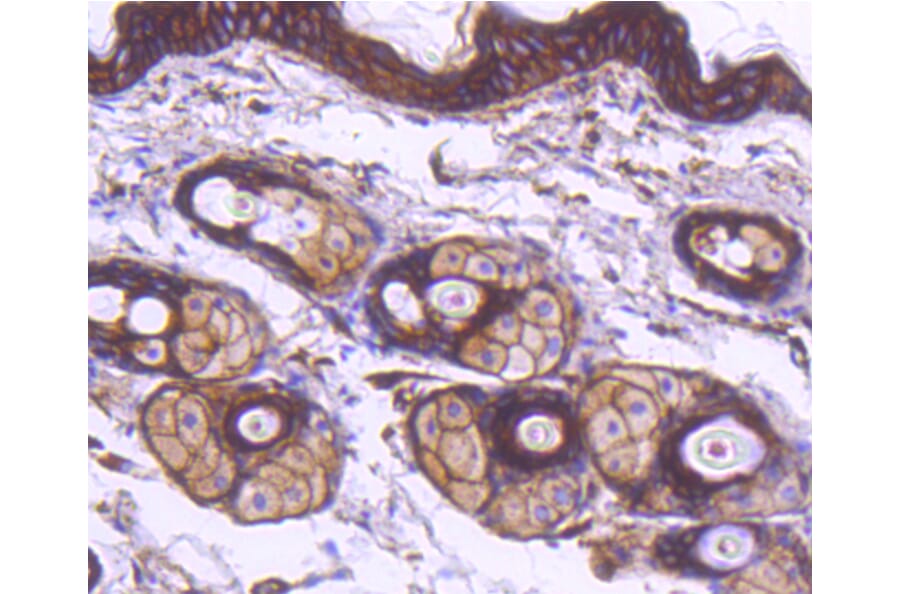 Immunohistochemistry - Anti-ACTA2 Antibody (A11111) - Antibodies.com