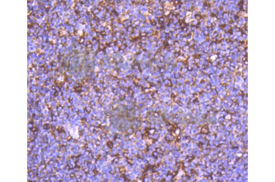Immunohistochemistry - Anti-ACTA2 Antibody (A11111) - Antibodies.com