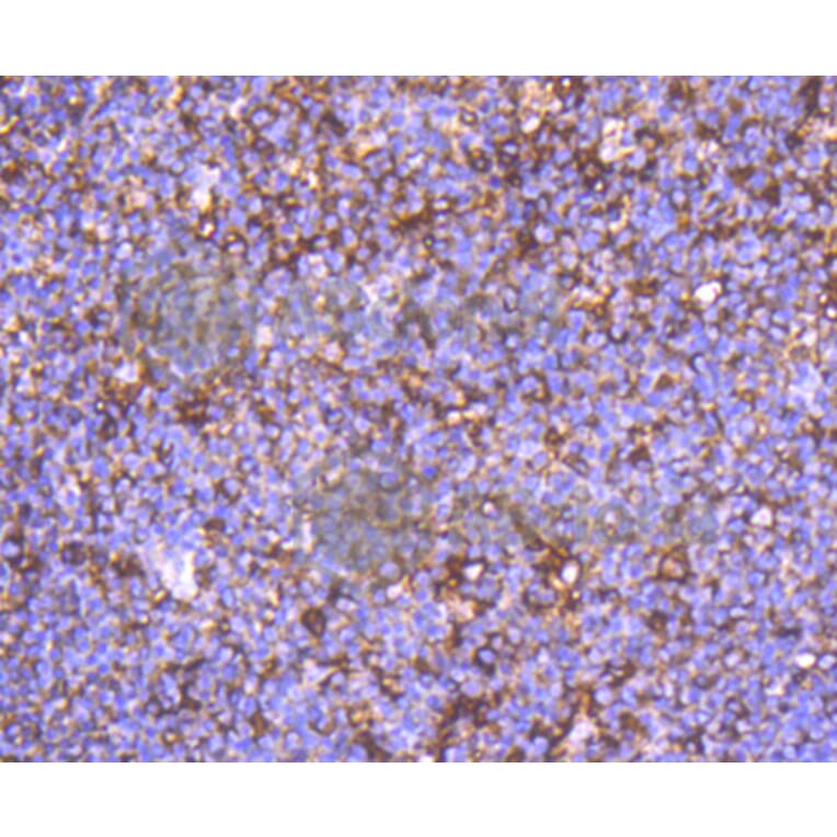 Immunohistochemistry - Anti-ACTA2 Antibody (A11111) - Antibodies.com