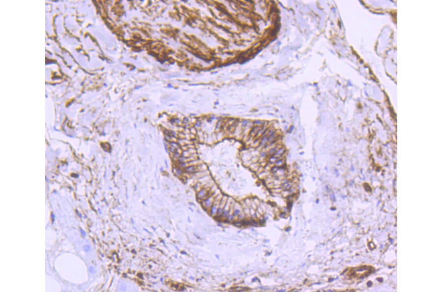 Immunohistochemistry - Anti-ACTA2 Antibody (A11111) - Antibodies.com