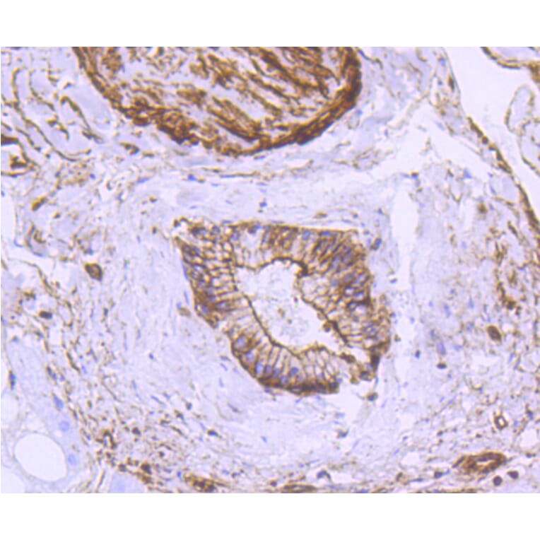 Immunohistochemistry - Anti-ACTA2 Antibody (A11111) - Antibodies.com