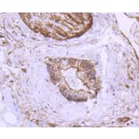 Immunohistochemistry - Anti-ACTA2 Antibody (A11111) - Antibodies.com