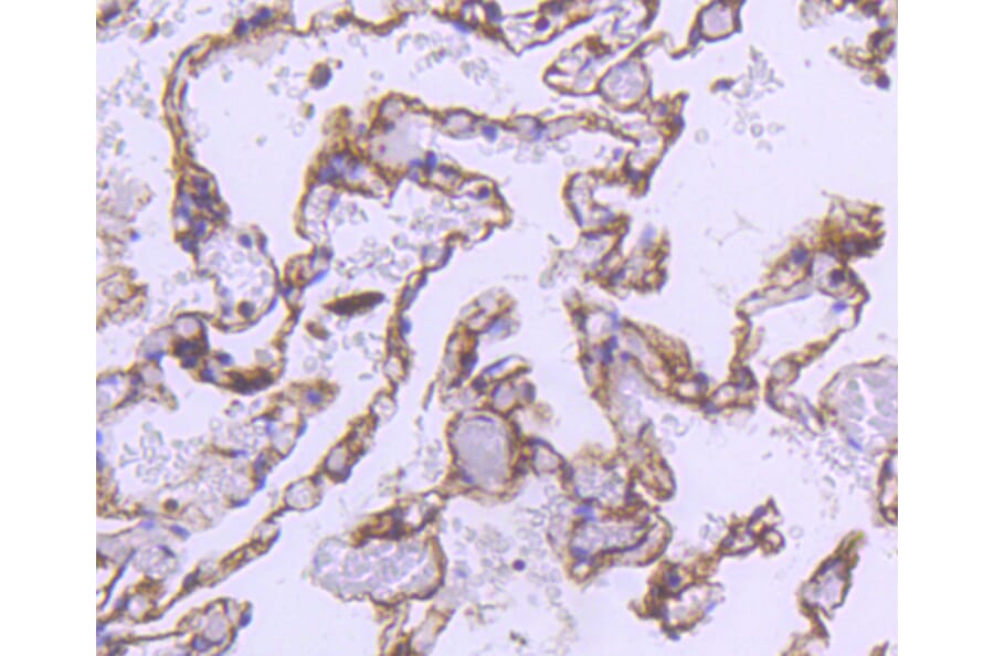 Immunohistochemistry - Anti-ACTA2 Antibody (A11111) - Antibodies.com