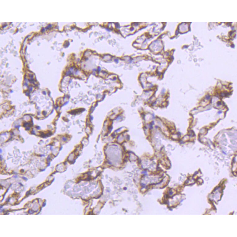 Immunohistochemistry - Anti-ACTA2 Antibody (A11111) - Antibodies.com