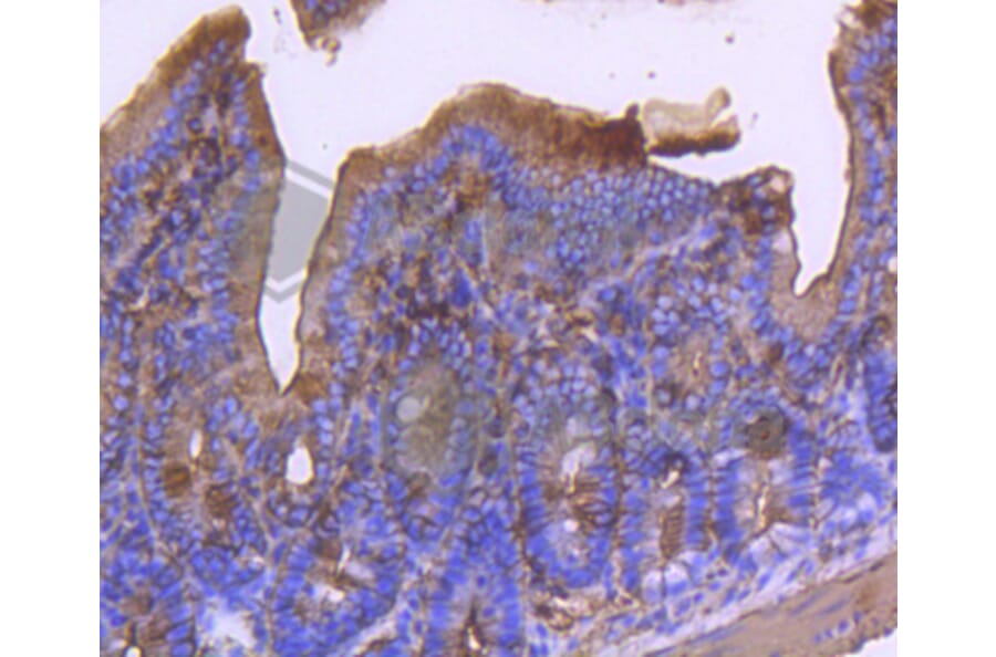 Immunohistochemistry - Anti-ACTA2 Antibody (A11111) - Antibodies.com
