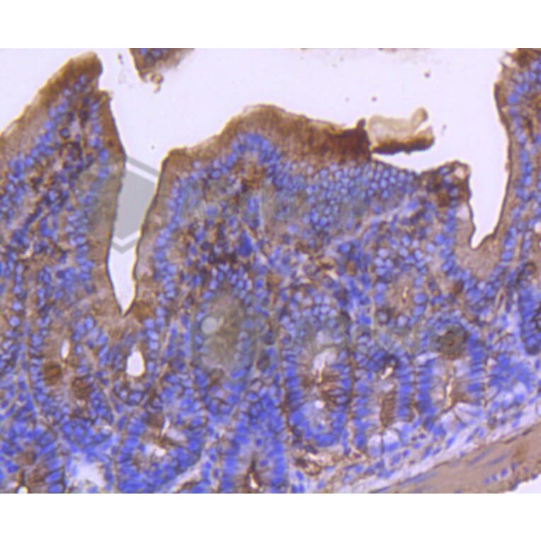 Immunohistochemistry - Anti-ACTA2 Antibody (A11111) - Antibodies.com
