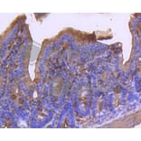 Immunohistochemistry - Anti-ACTA2 Antibody (A11111) - Antibodies.com