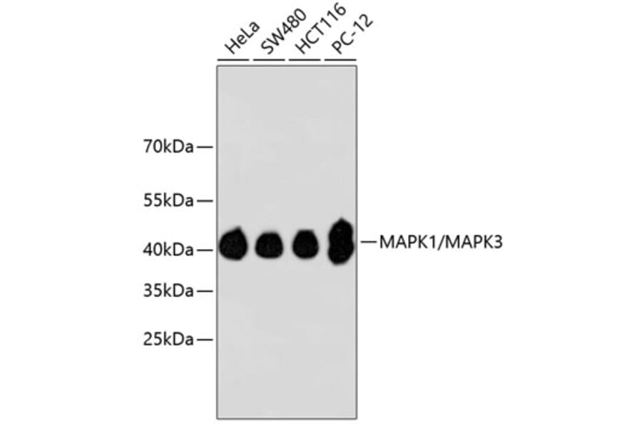 Western Blot - Anti-ERK1 + ERK2 Antibody (A11116) - Antibodies.com