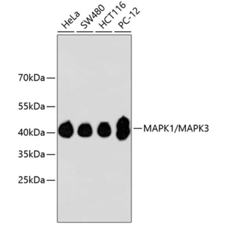 Western Blot - Anti-ERK1 + ERK2 Antibody (A11116) - Antibodies.com