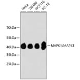 Western Blot - Anti-ERK1 + ERK2 Antibody (A11116) - Antibodies.com
