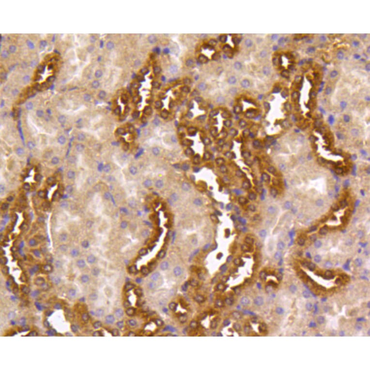 Immunohistochemistry - Anti-MEK1 + MEK2 Antibody (A11122) - Antibodies.com