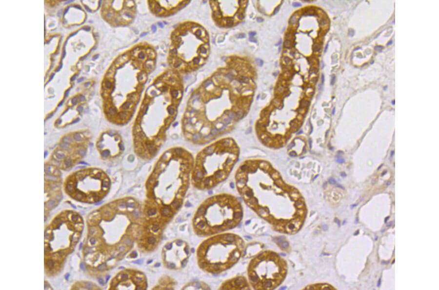 Immunohistochemistry - Anti-MEK1 + MEK2 Antibody (A11122) - Antibodies.com