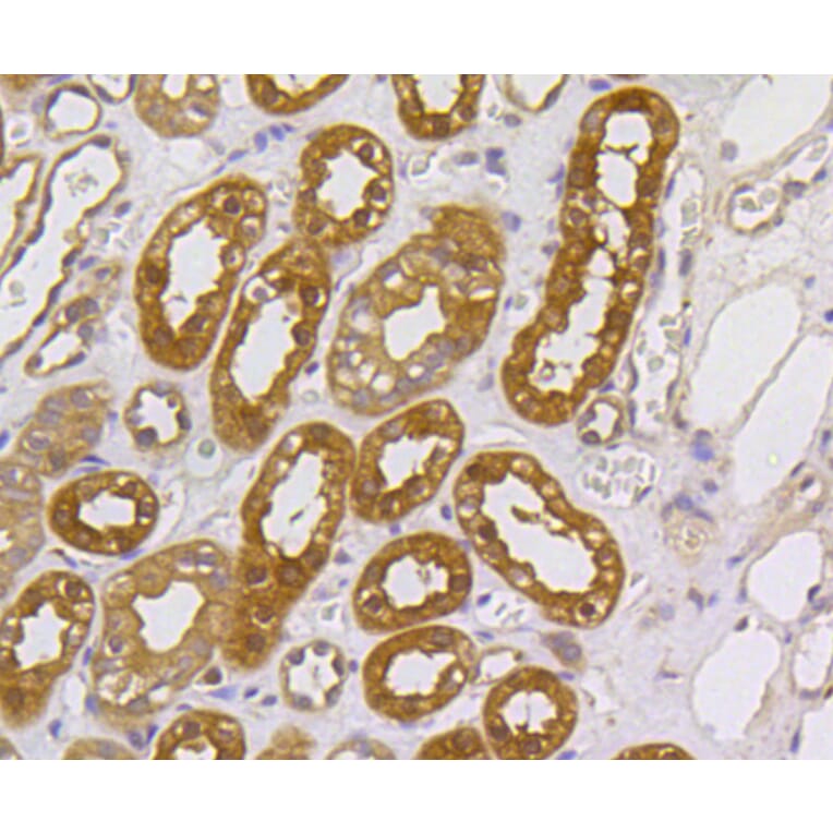 Immunohistochemistry - Anti-MEK1 + MEK2 Antibody (A11122) - Antibodies.com
