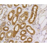 Immunohistochemistry - Anti-MEK1 + MEK2 Antibody (A11122) - Antibodies.com