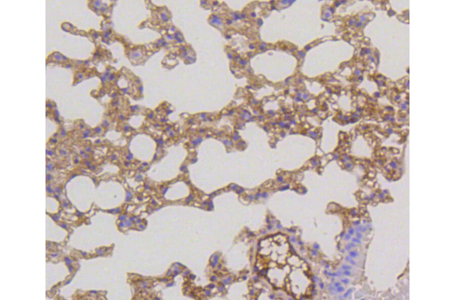 Immunohistochemistry - Anti-MEK1 + MEK2 Antibody (A11122) - Antibodies.com