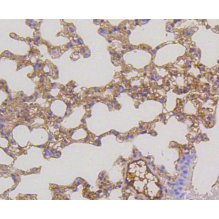 Immunohistochemistry - Anti-MEK1 + MEK2 Antibody (A11122) - Antibodies.com