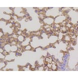 Immunohistochemistry - Anti-MEK1 + MEK2 Antibody (A11122) - Antibodies.com