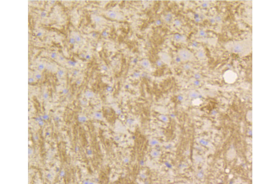 Immunohistochemistry - Anti-STAT3 Antibody (A11185) - Antibodies.com