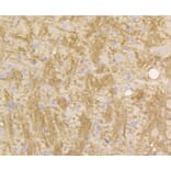 Immunohistochemistry - Anti-STAT3 Antibody (A11185) - Antibodies.com