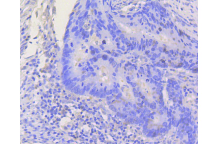 Immunohistochemistry - Anti-STAT3 Antibody (A11185) - Antibodies.com