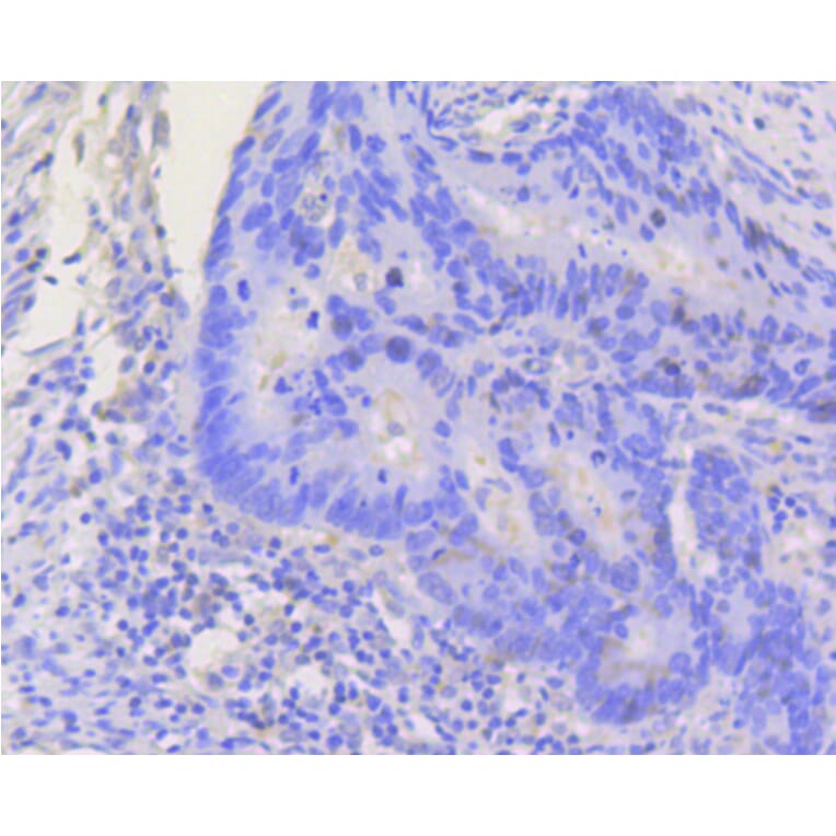 Immunohistochemistry - Anti-STAT3 Antibody (A11185) - Antibodies.com