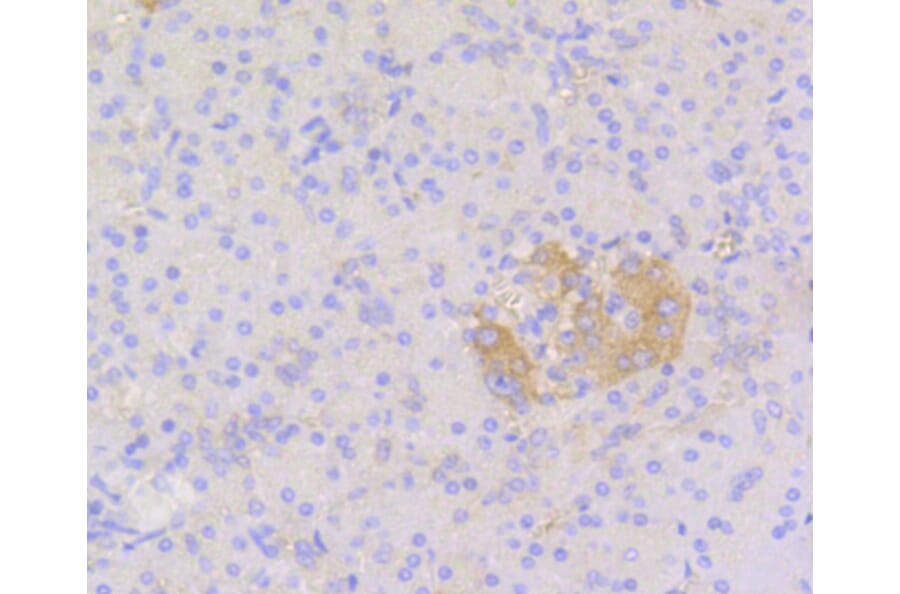 Immunohistochemistry - Anti-STAT3 Antibody (A11185) - Antibodies.com