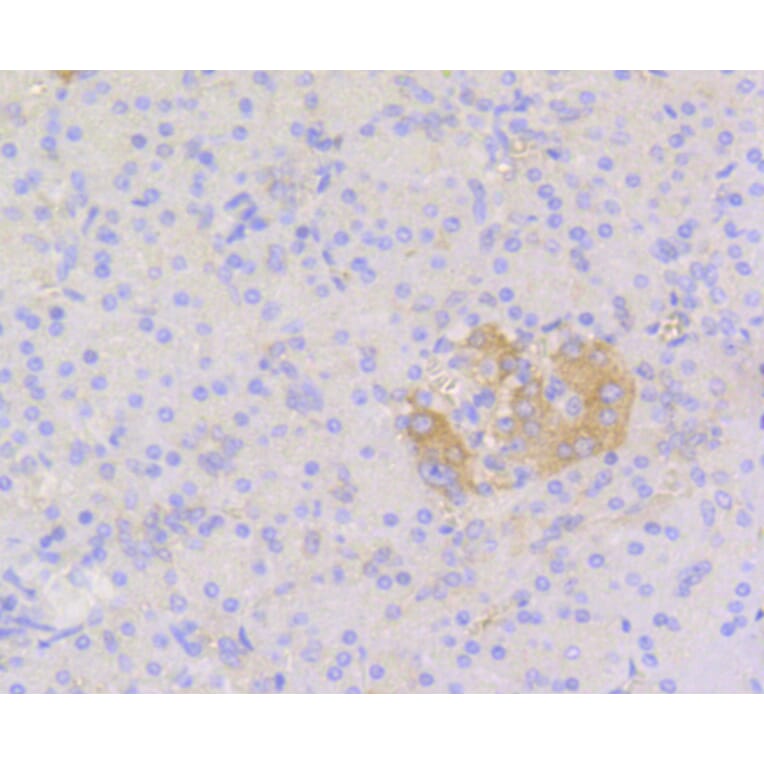 Immunohistochemistry - Anti-STAT3 Antibody (A11185) - Antibodies.com