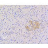 Immunohistochemistry - Anti-STAT3 Antibody (A11185) - Antibodies.com