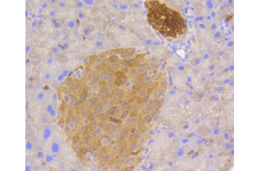 Immunohistochemistry - Anti-STAT3 Antibody (A11185) - Antibodies.com