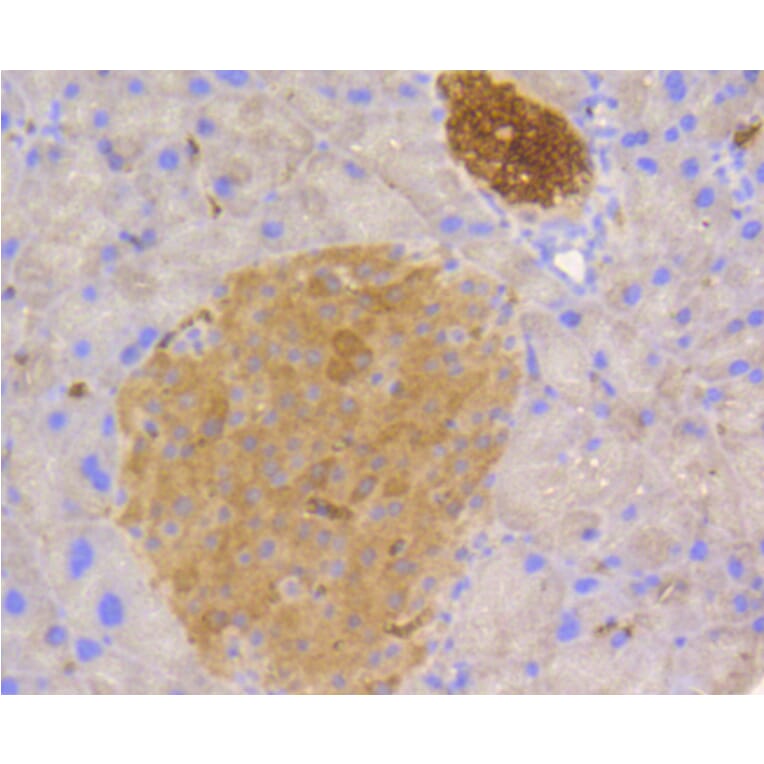 Immunohistochemistry - Anti-STAT3 Antibody (A11185) - Antibodies.com
