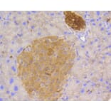 Immunohistochemistry - Anti-STAT3 Antibody (A11185) - Antibodies.com