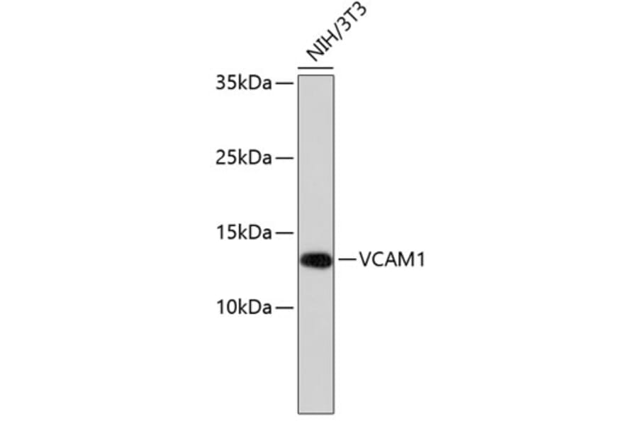 Western Blot - Anti-VCAM1 Antibody (A11236) - Antibodies.com