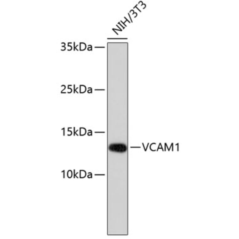 Western Blot - Anti-VCAM1 Antibody (A11236) - Antibodies.com