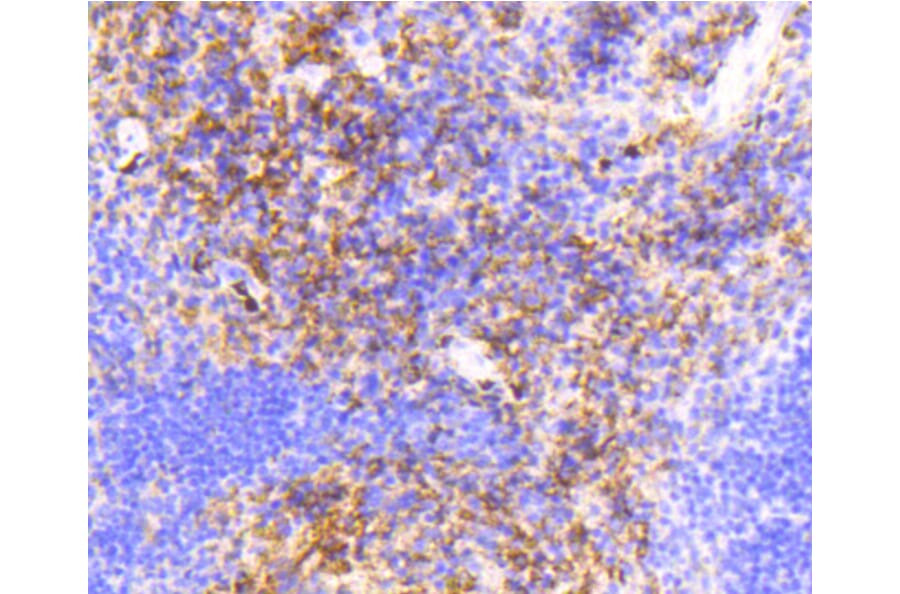 Immunohistochemistry - Anti-VCAM1 Antibody (A11236) - Antibodies.com