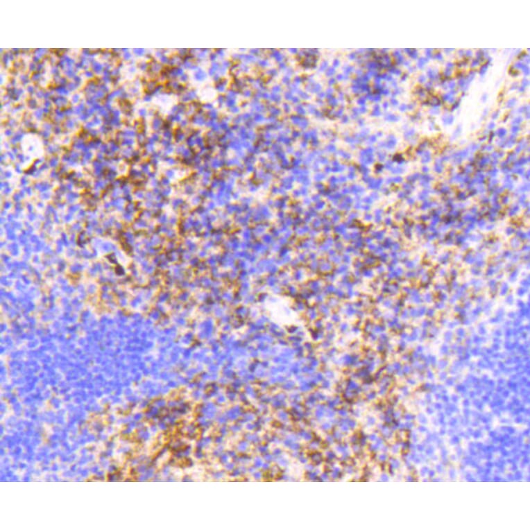Immunohistochemistry - Anti-VCAM1 Antibody (A11236) - Antibodies.com