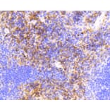 Immunohistochemistry - Anti-VCAM1 Antibody (A11236) - Antibodies.com