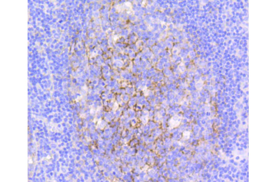 Immunohistochemistry - Anti-VCAM1 Antibody (A11236) - Antibodies.com