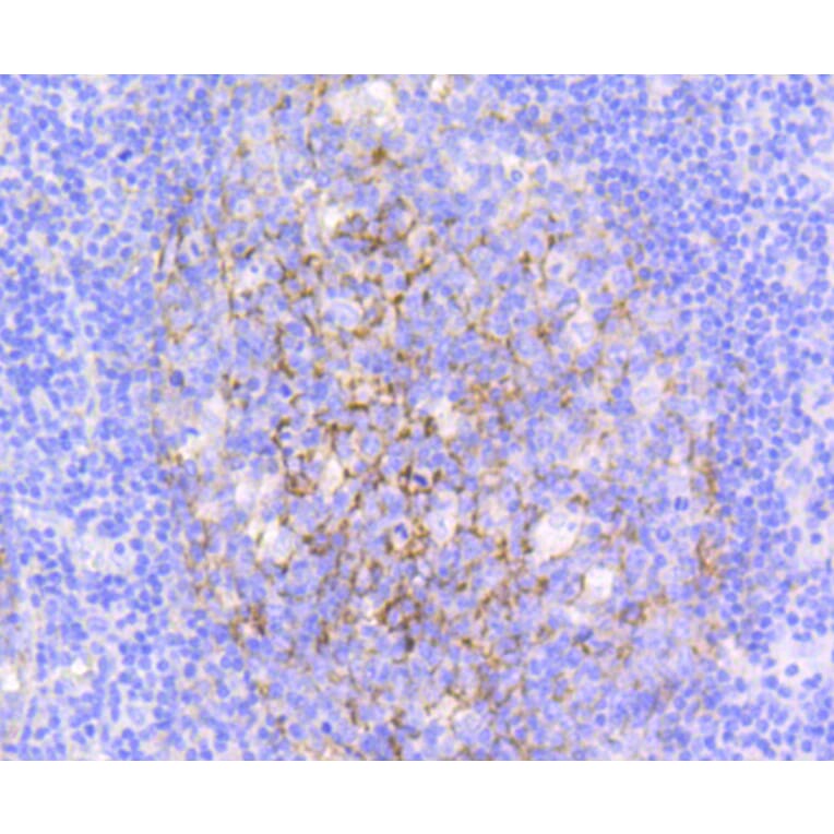 Immunohistochemistry - Anti-VCAM1 Antibody (A11236) - Antibodies.com