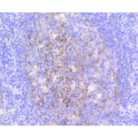 Immunohistochemistry - Anti-VCAM1 Antibody (A11236) - Antibodies.com